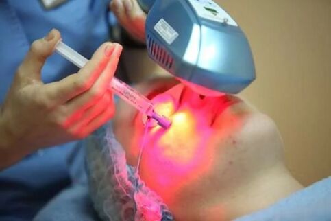 Laser biorevitalization of the facial skin